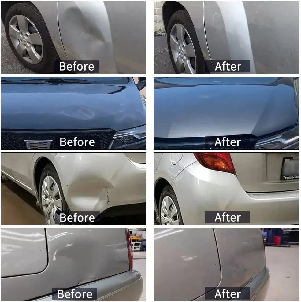 Dent Removal Car Body Repair Kit